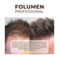 FOLUMEN® HAARFASER