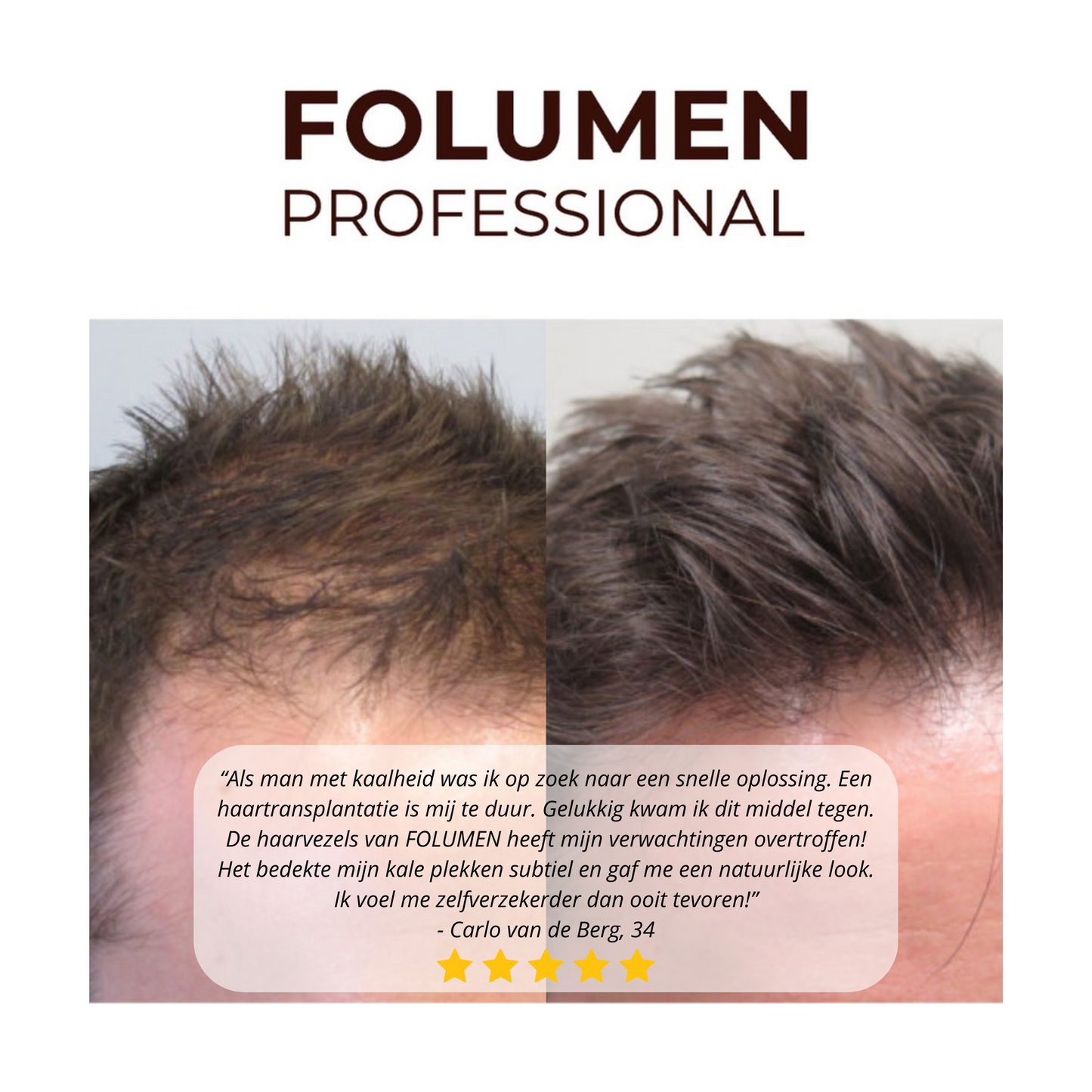 FOLUMEN® APPLICATOR