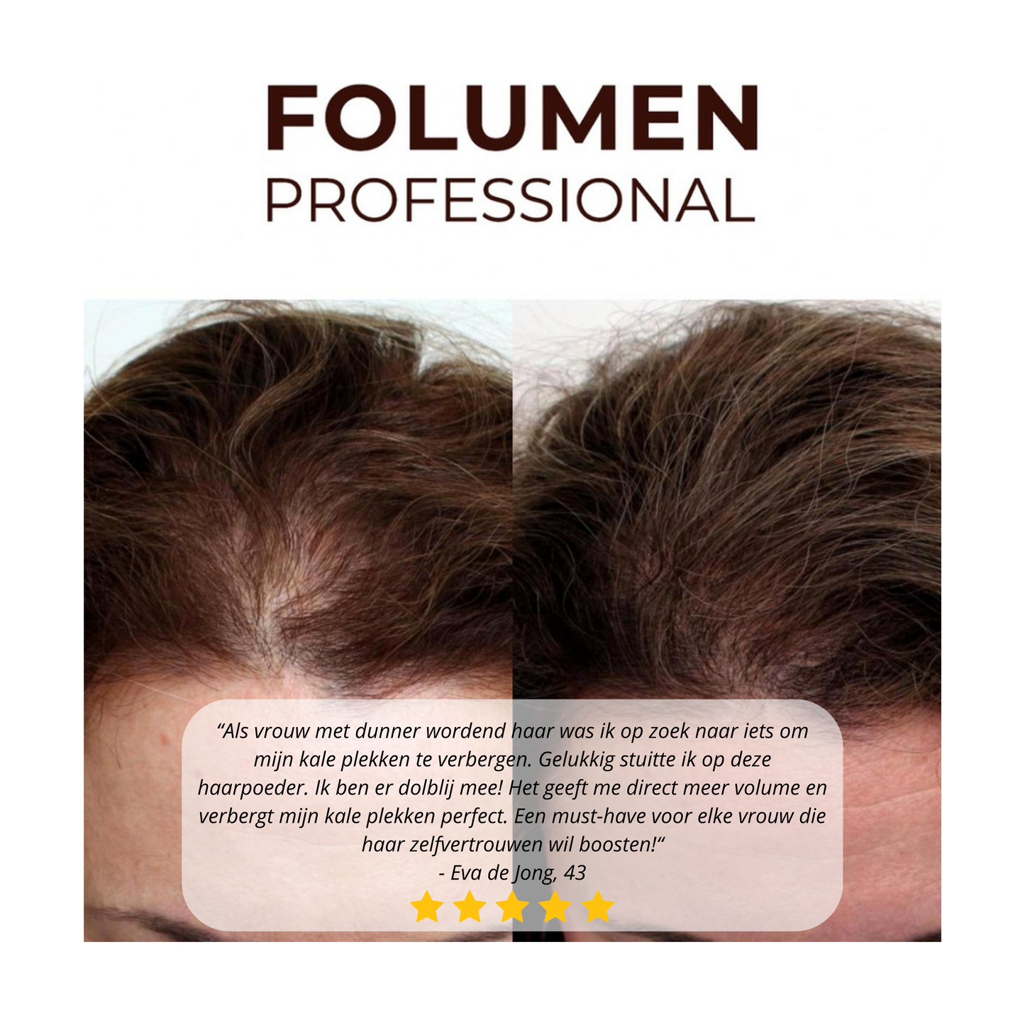 FOLUMEN® HAARFASER