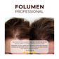 FOLUMEN® APPLIKATOR